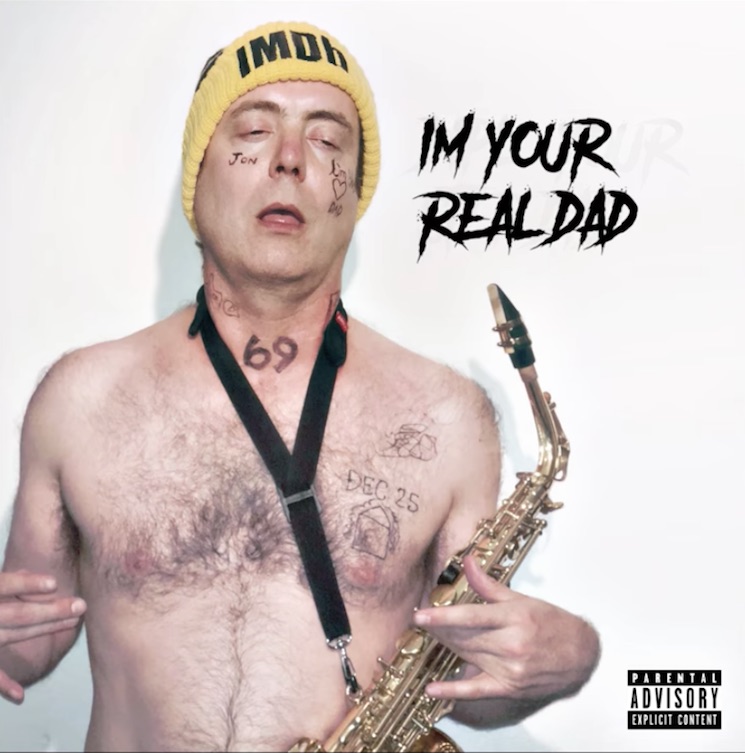 Comedian Jon Daly Just Dropped a Lil Xan Diss Track 