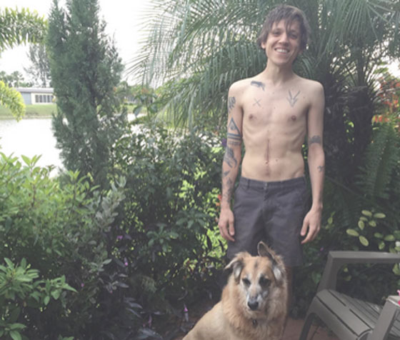 Surfer Blood's Thomas Fekete Diagnosed with Cancer, Launches Crowdfunding Campaign 