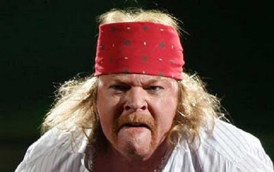 Axl Rose Is Trying to Remove "Fat" Photos from the Internet | Exclaim!