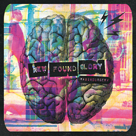 New Found Glory Radiosurgery